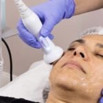 Ultrasonido facial en cusco